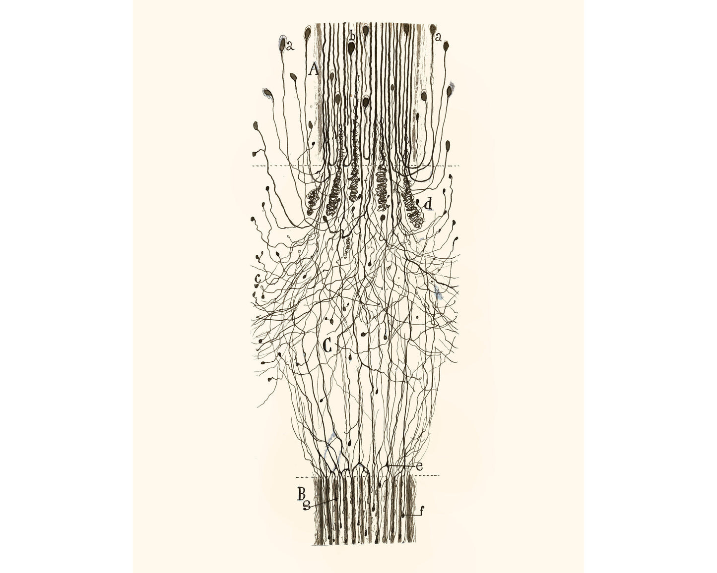 Cut Nerve Outside the Spinal Cord | 1913